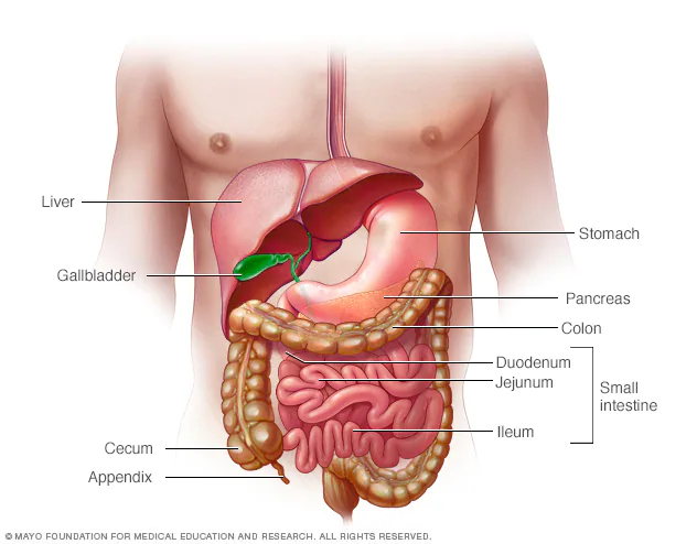 Crohn disease